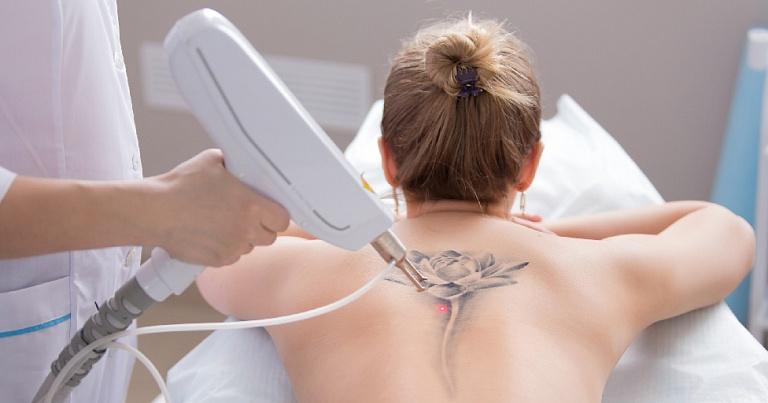 Почему сведение татуировки болезненнее и дороже ее нанесения