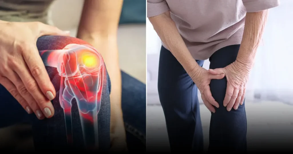 Шиповник против боли при остеоартрите: ранние исследования датских учёных