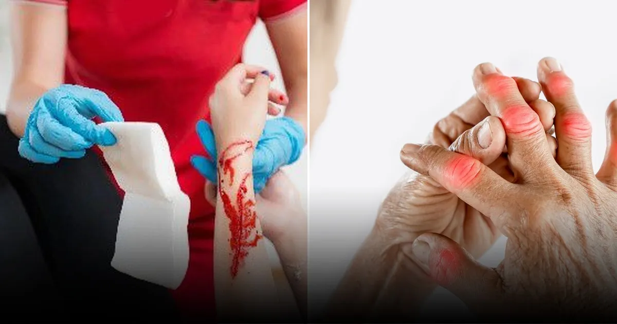 Названы опасности мелких бытовых травм: как избежать осложнений Названы опасности мелких бытовых травм: как избежать осложнений